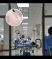 308纳米准分子激光仪